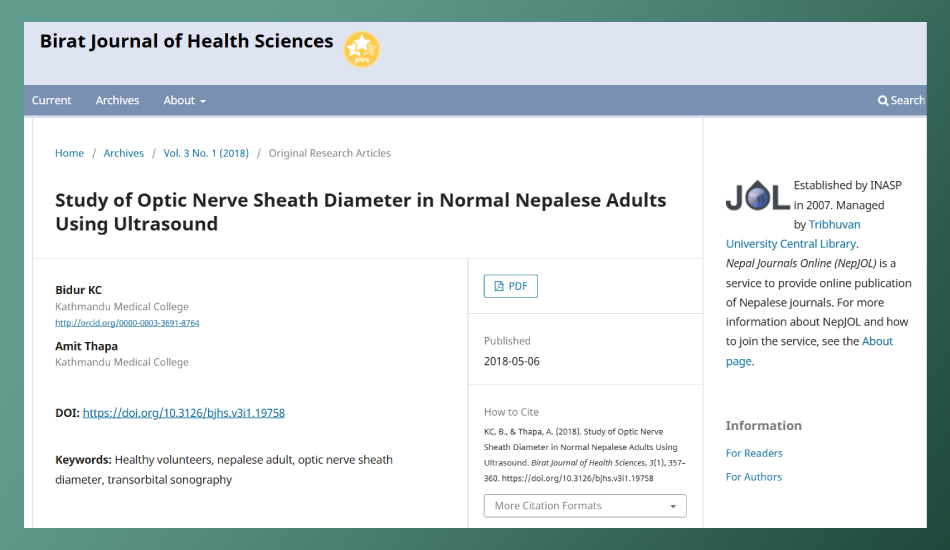 Study of Optic Nerve Sheath Diameter In Normal Nepalese Adults Using Ultrasound